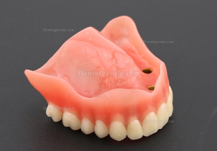 Anatomisches Modell der Zahnz&auml;hne &Uuml;berprothese Superior mit 4 Implantaten Demo Modell 6001